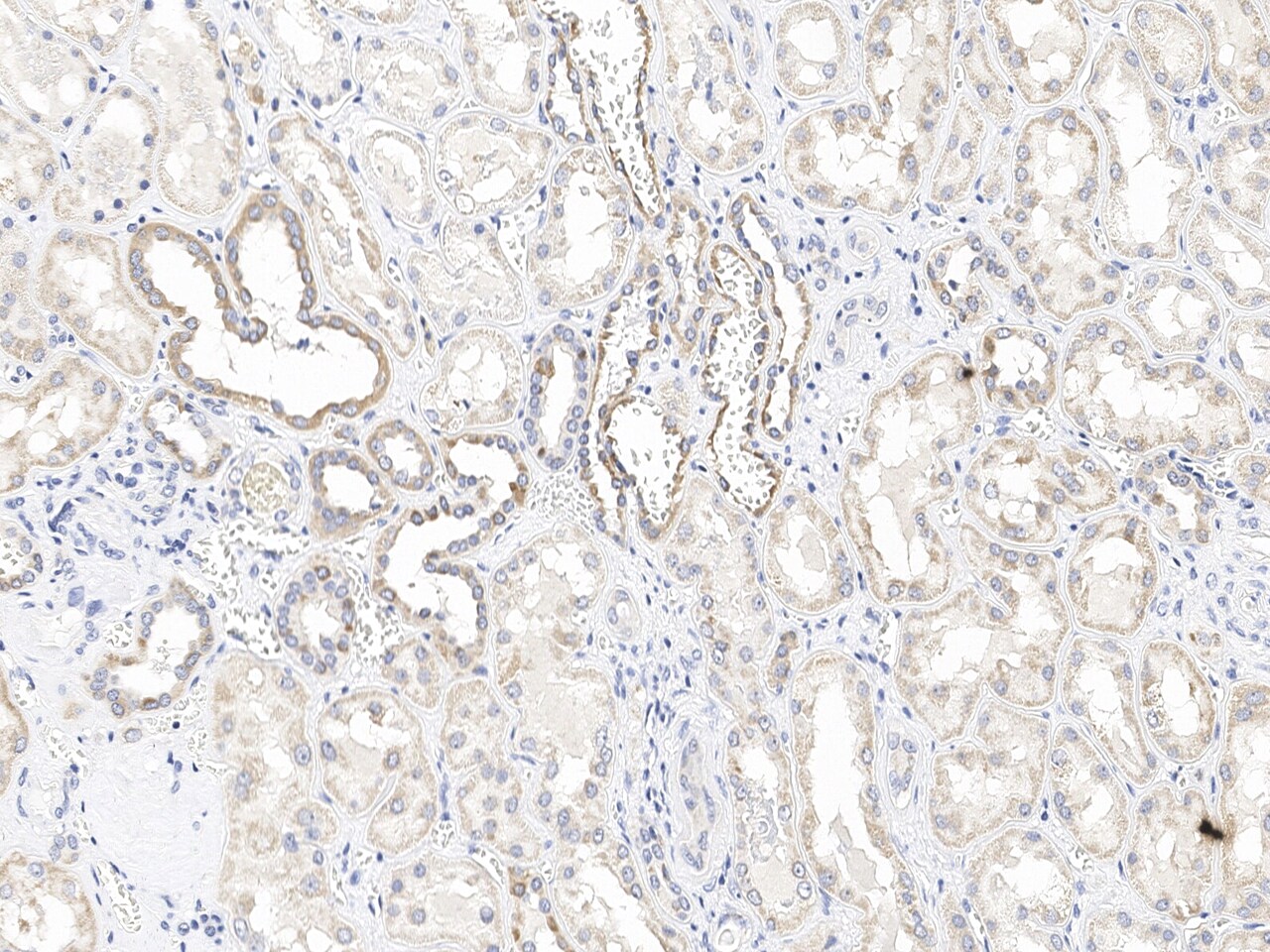 HIGD2A Antibody Immunohistochemistry-Paraffin: HIGD2A Antibody [NBP3-21440]