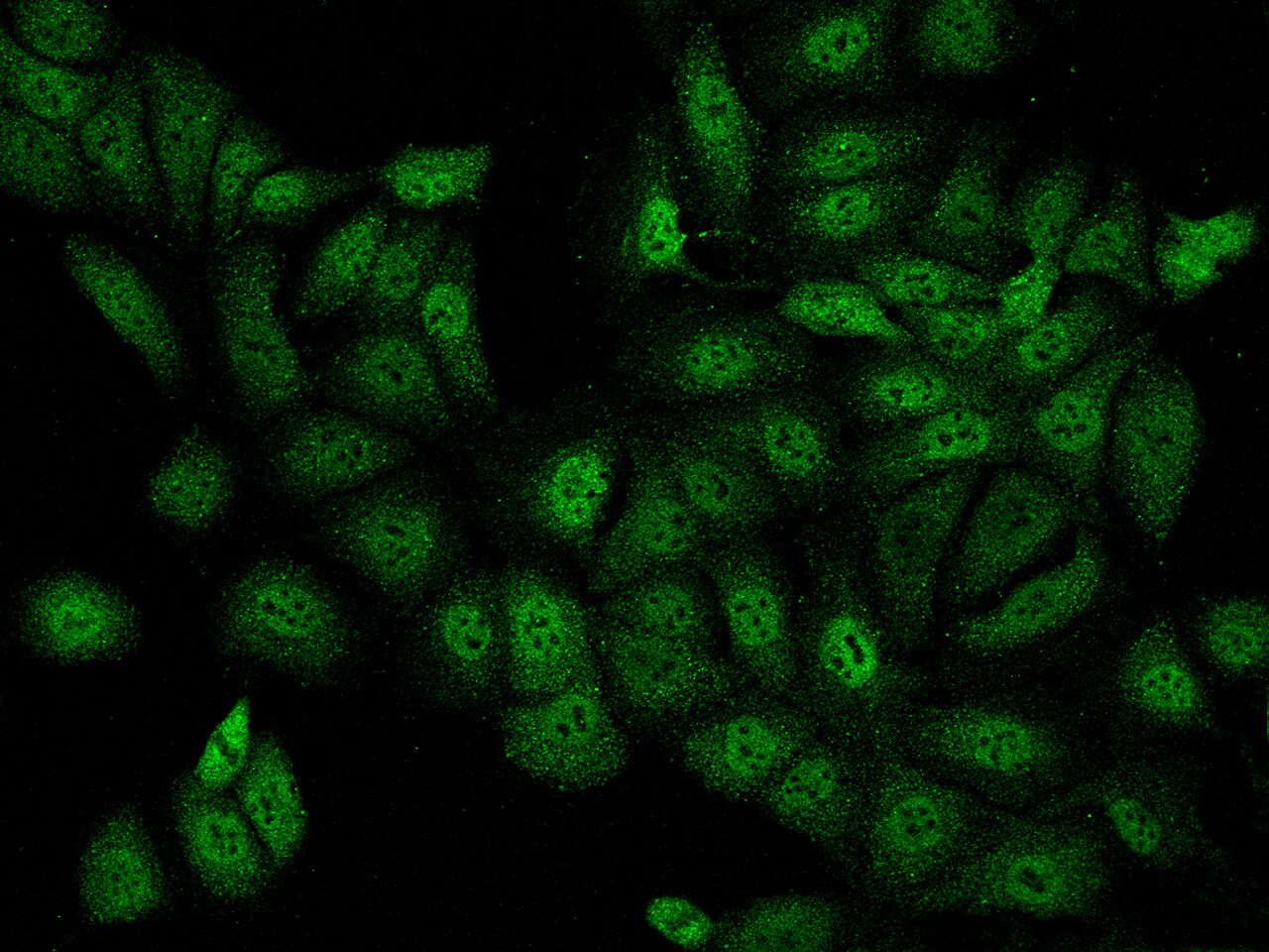 Iroquois-class homeodomain protein IRX-5 Antibody - BSA Free