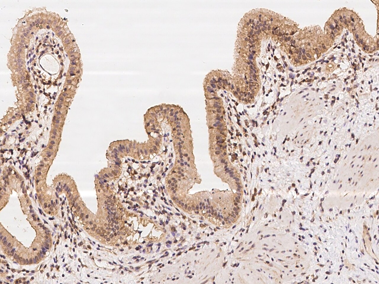 TBC1D1 Antibody