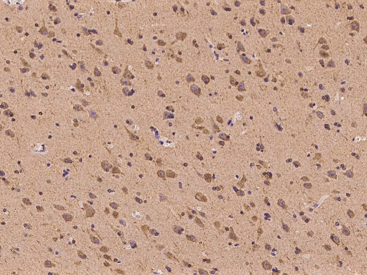 RPS4X Antibody