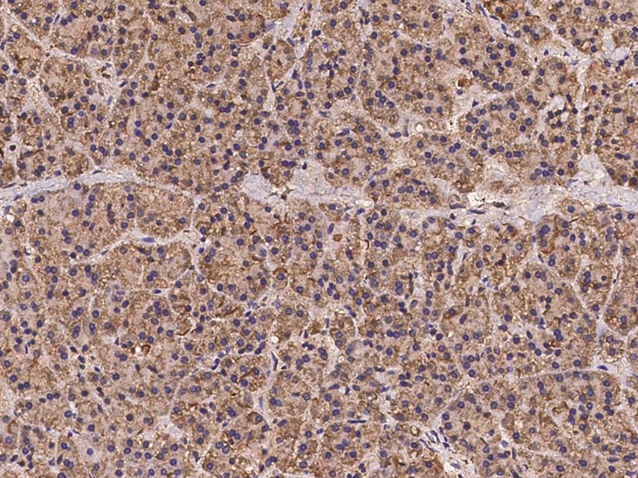 RPS4X Antibody