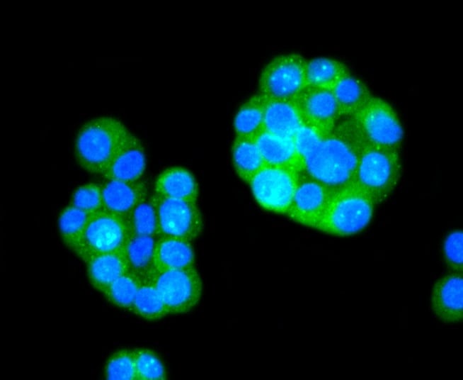 Tau [p Ser396] Antibody (SN62-09)