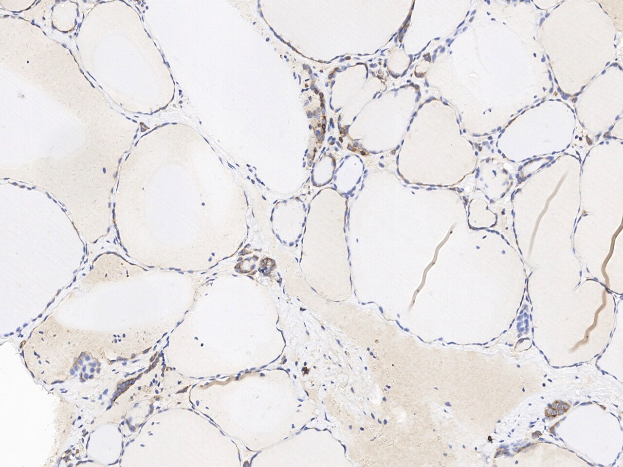 FAM119A Antibody