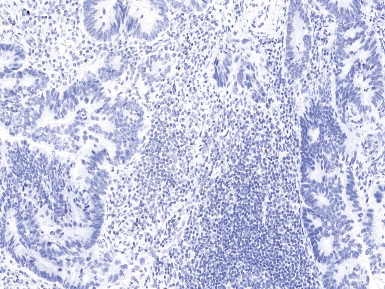 FoxP3 Antibody (02)