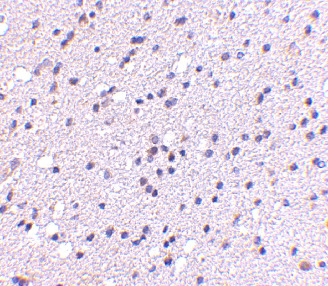 CADPS2 Antibody - BSA Free