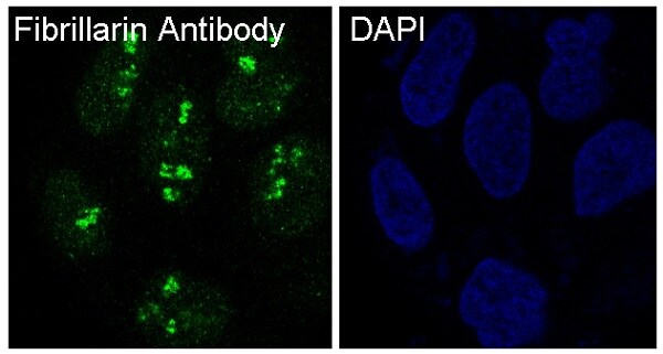 Fibrillarin Antibody (SR1545) - BSA Free