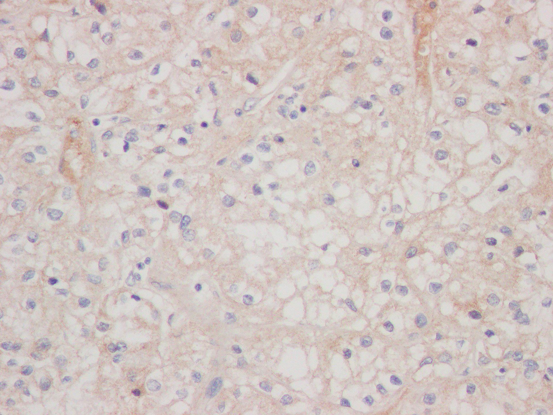 DARC Antibody (SR1582) - BSA Free