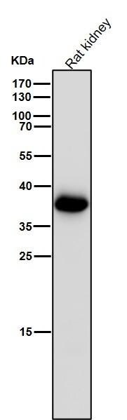 Aldo-keto Reductase 1C3/AKR1C3 Antibody (SR1612)