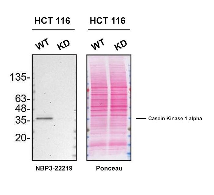 Casein Kinase 1 alpha Antibody (SR1581)