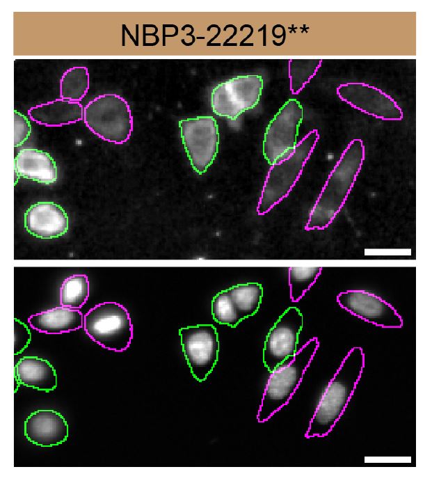 Casein Kinase 1 alpha Antibody (SR1581)