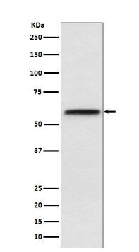 LCAT Antibody (SR1989)