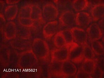 Aldehyde Dehydrogenase 1-A1/ALDH1A1 Antibody (M562)