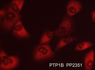 PTP1B/PTPN1 Antibody