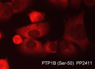PTP1B/PTPN1 [p Ser50] Antibody
