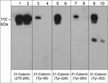 p120-catenin [p Tyr228] Antibody (M356)