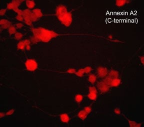 Annexin A2 Antibody (M298)
