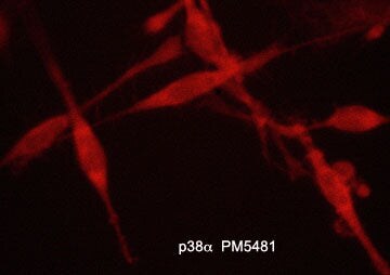 p38 alpha Antibody (M548)