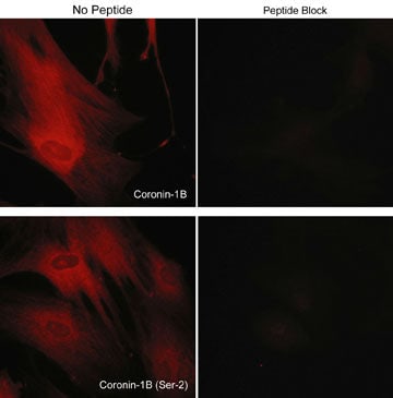 CORO1B Antibody