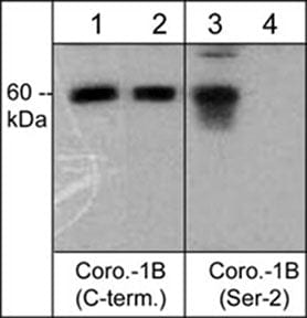 CORO1B [p Ser2] Antibody