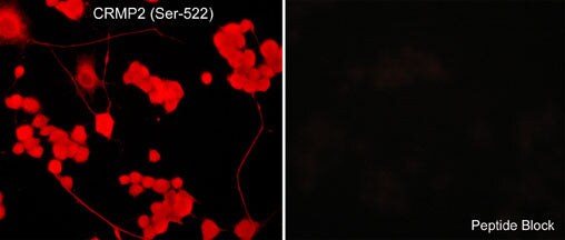 CRMP2 [p Ser522] Antibody