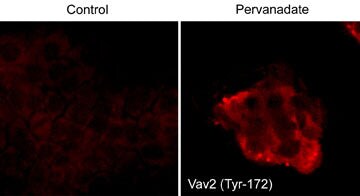 VAV2 [p Tyr172] Antibody