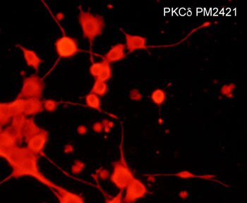 PKC delta Antibody (M242)