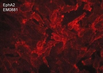 EphA2 Antibody (M088)
