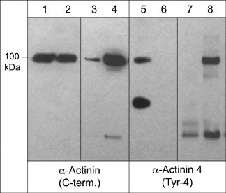Alpha Actinin 4 [p Tyr4] Antibody