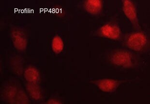 Profilin 1 Antibody