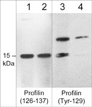 Profilin 1 [p Tyr129] Antibody