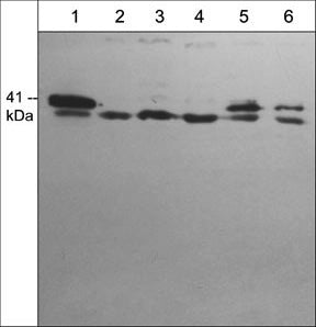 actin-related protein 2/3 complex subunit 1B Antibody