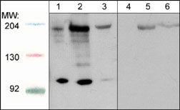 ROBO1 Antibody