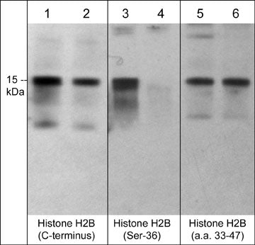 Histone H2B type 1B Antibody