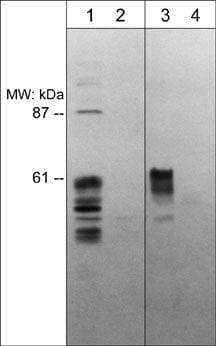 Semaphorin 3E Antibody
