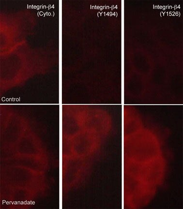 Integrin beta 4/CD104 Antibody (M126)