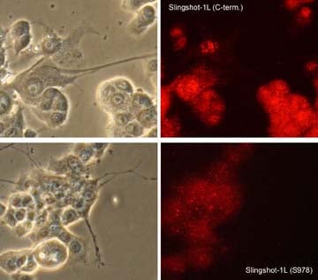 SSH1 [p Ser978] Antibody