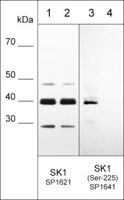Sphingosine Kinase 1/SPHK1 Antibody