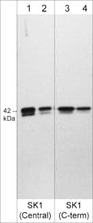 Sphingosine Kinase 1/SPHK1 Antibody