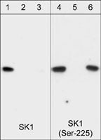 Sphingosine Kinase 1/SPHK1 [p Ser225] Antibody