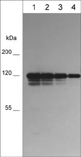 P-Cadherin Antibody (M596)