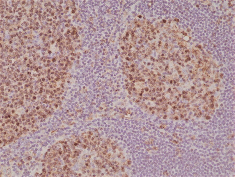 Stathmin 1 Antibody (RM350)