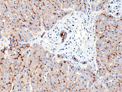 Aminopeptidase N/CD13 Antibody (RM403)