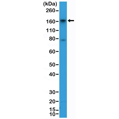 Aminopeptidase N/CD13 Antibody (RM403)
