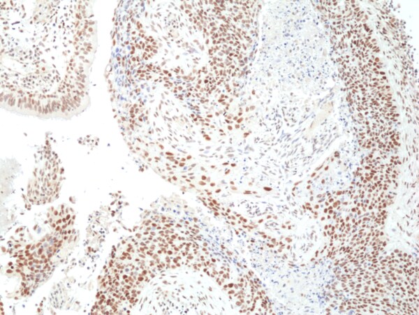 HDAC3 Antibody (RM439)