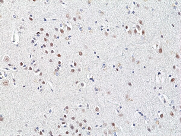 HDAC3 Antibody (RM439)