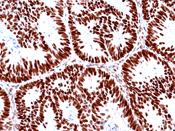 MSH2 Antibody (RM478)