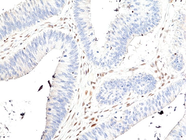 MSH2 Antibody (RM478)