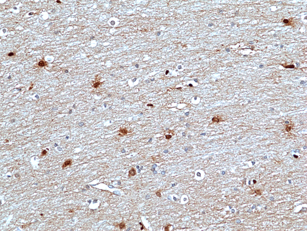 ERK2 Antibody (RM483)