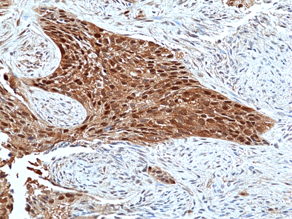ERK2 Antibody (RM483)
