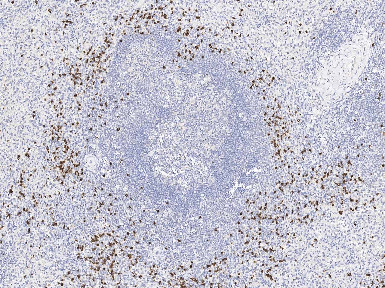 Lipocalin-2/NGAL Antibody (508)